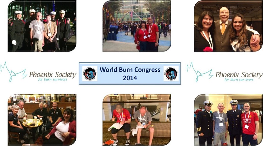 World Burn Congress